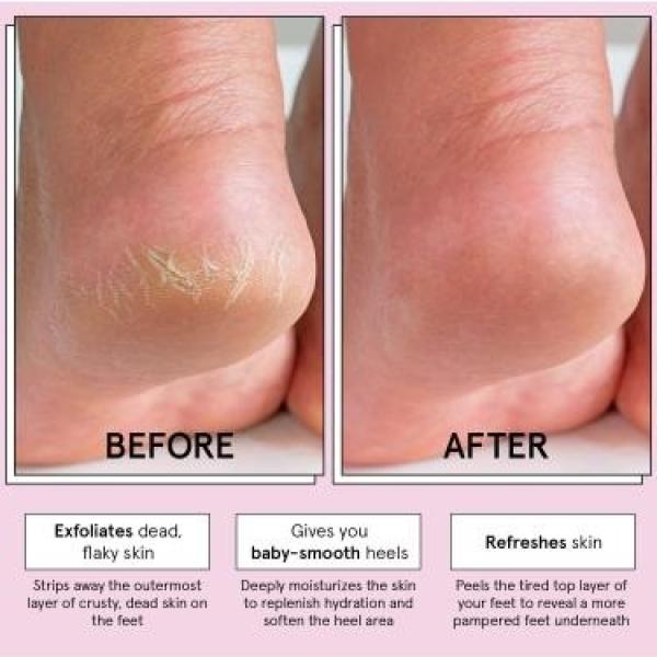Exfoliating Foot Mask 2 Pair