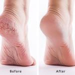 Exfoliating Foot Mask 2 Pair